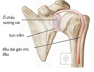 Tổn thương sụn viền và gân nhị đầu dài: 1 trong những nguyên nhân gây đau khớp vai