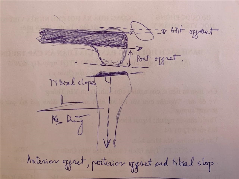 NGUYÊN TẮC CỦA PHẪU THUẬT THAY KHỚP GỐI: CẮT XƯƠNG CHUẨN, CÂN BẰNG KHOẢNG HAY PHỐI HỢP